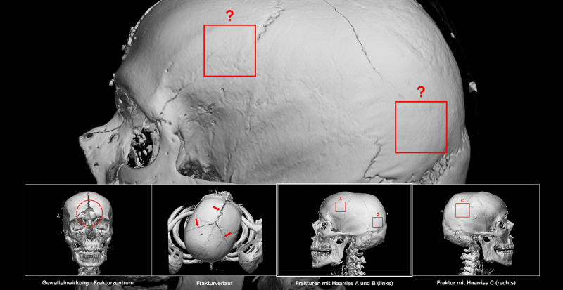 Colour and Knowledge in Virtual Autopsy (Virtopsy)